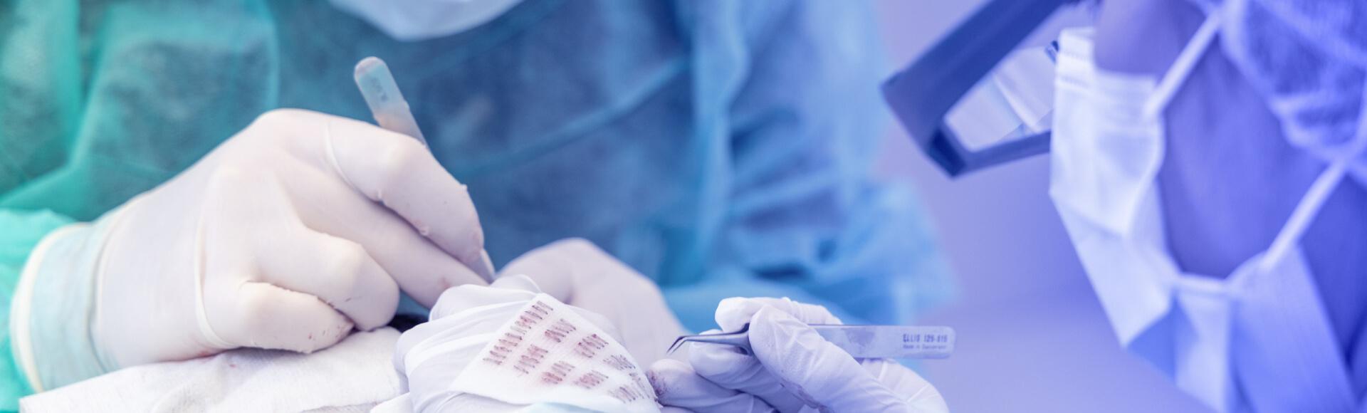 Hair transplant technician at work at HCI Clinics