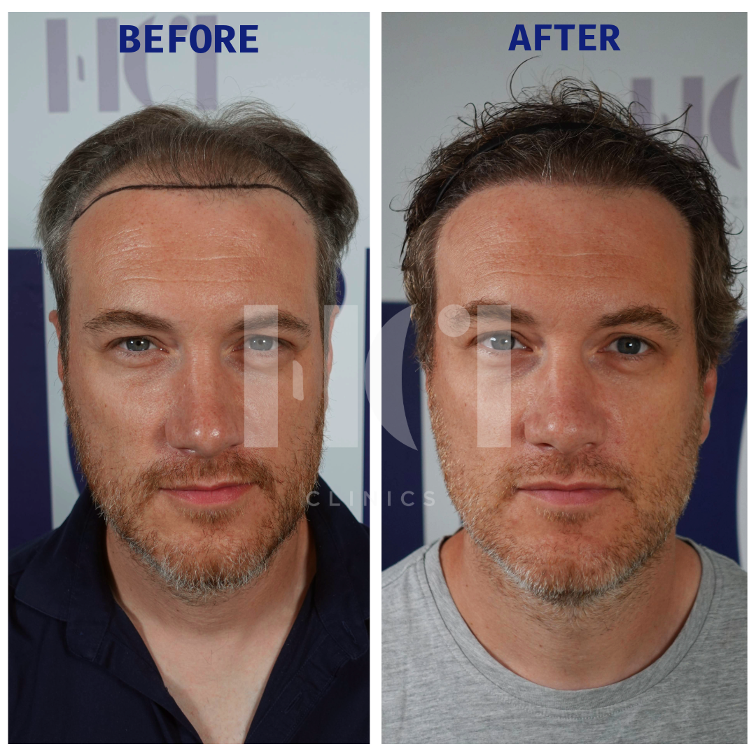Before / After