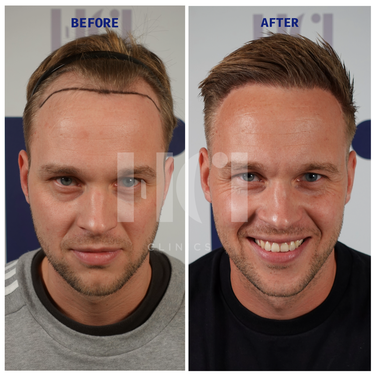 Before / After