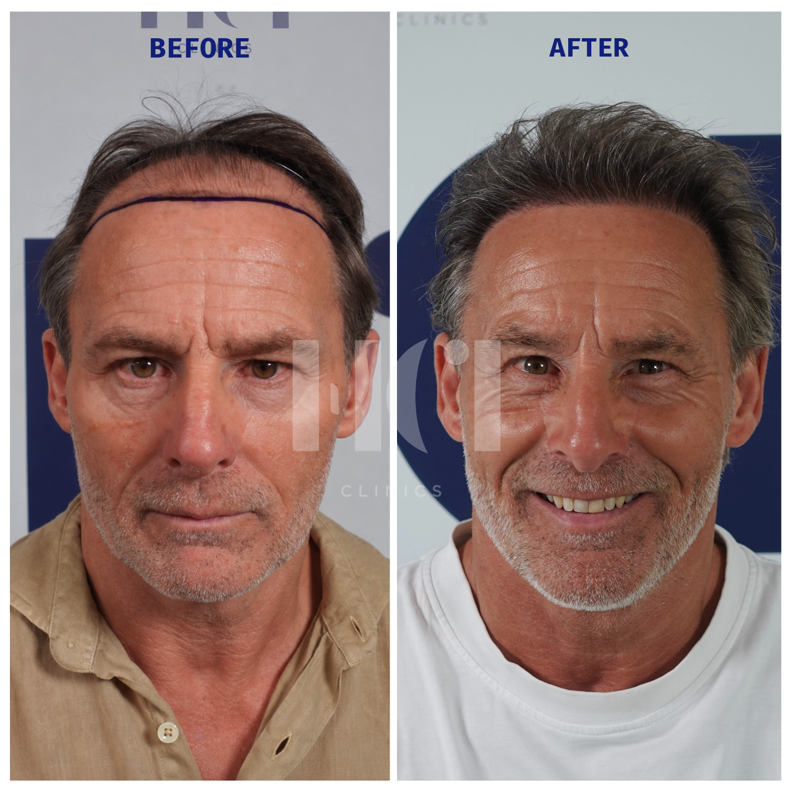 Before / After