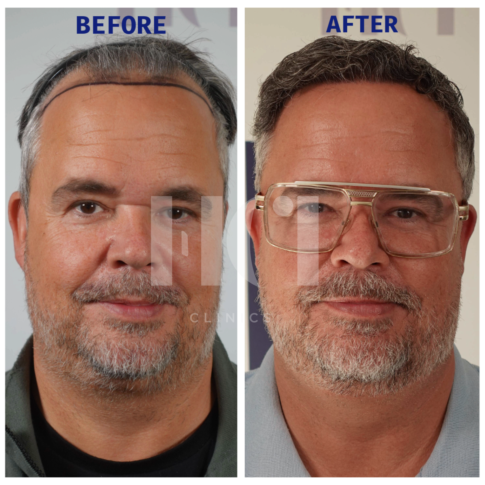 Before / After