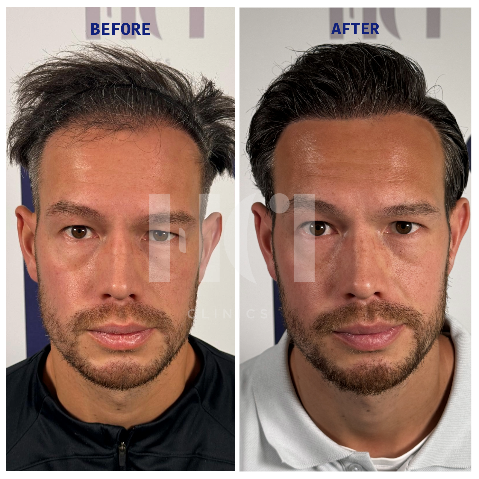 Before / After