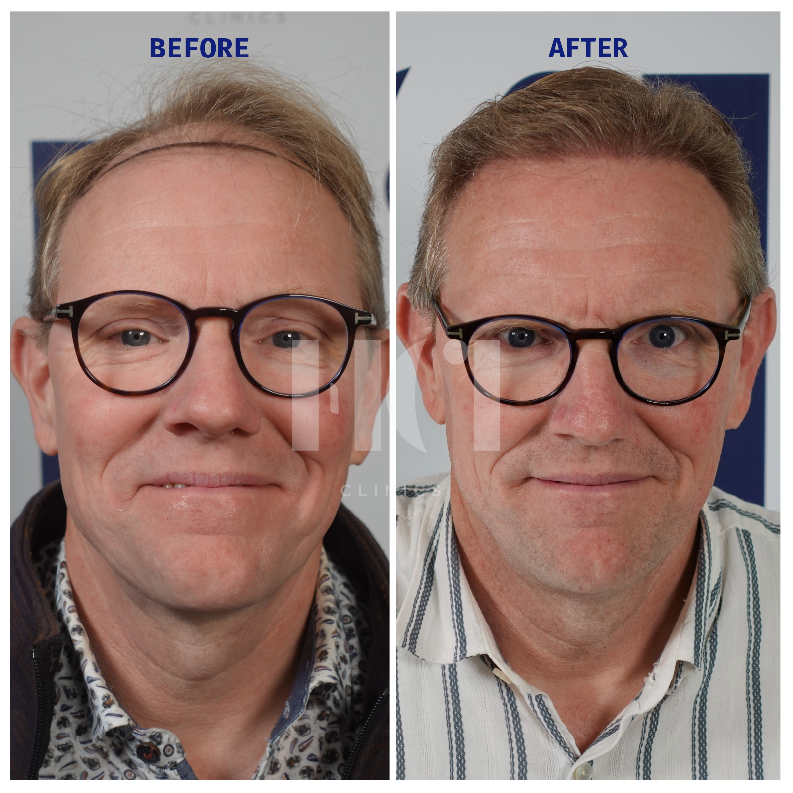 Before / After