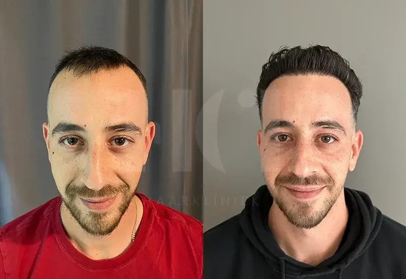 Before / After