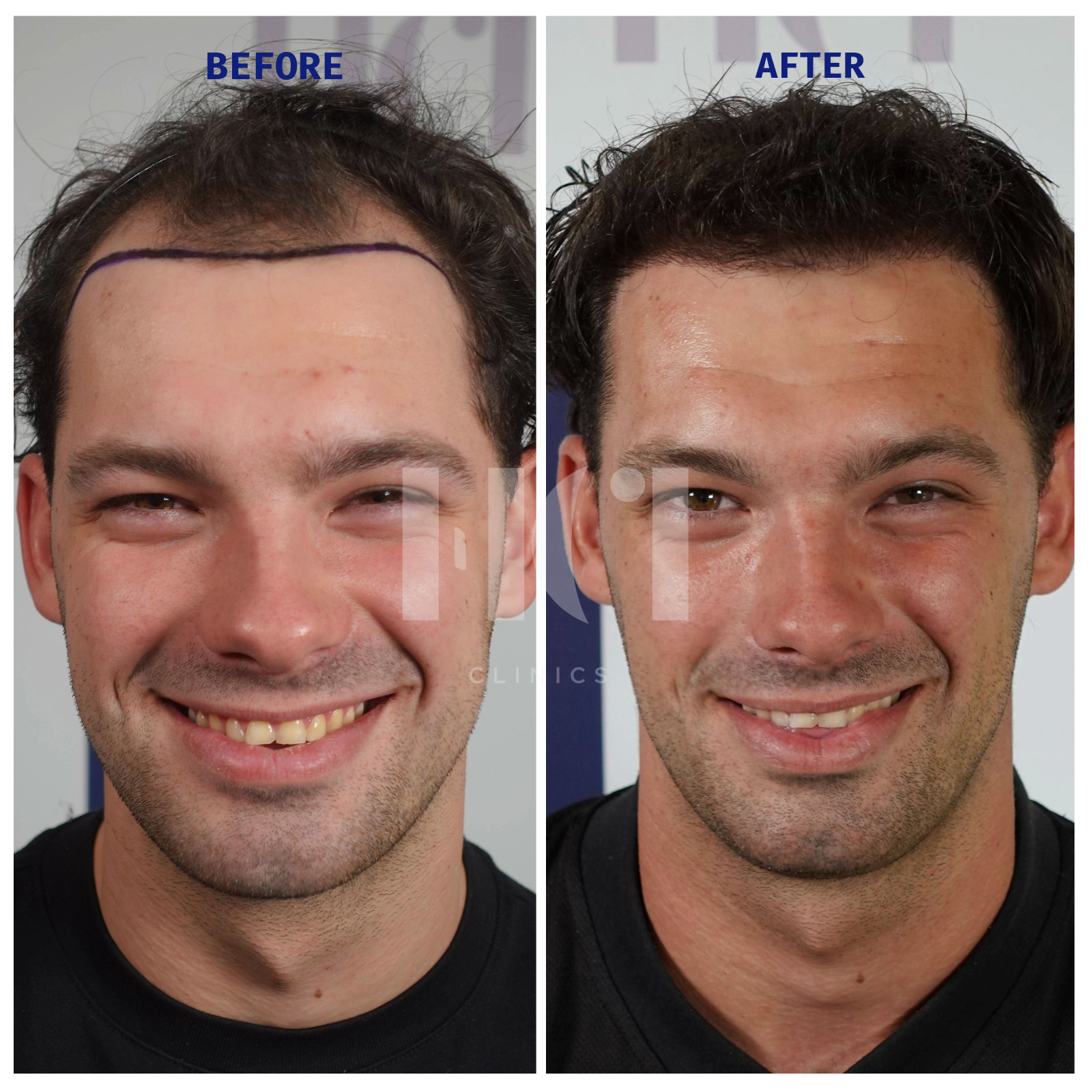 Before / After